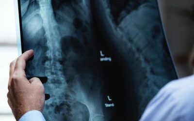 Pruebas de imagen en dolor lumbar. ¿Para qué sirven y para qué no? ¿Hasta qué punto son útiles?